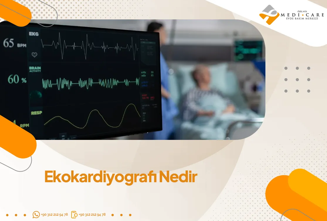 Ekokardiyografi Nedir