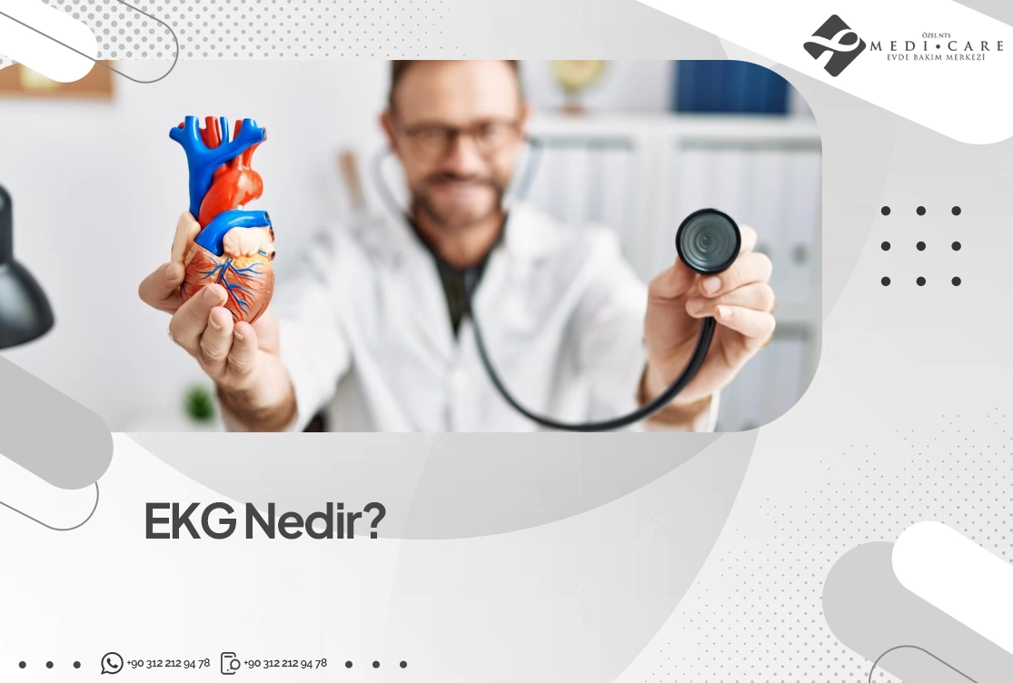 ekg-nedir