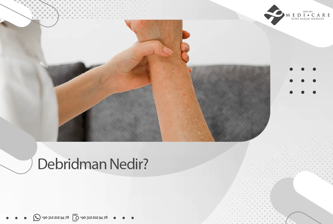 debridman-nedir-001