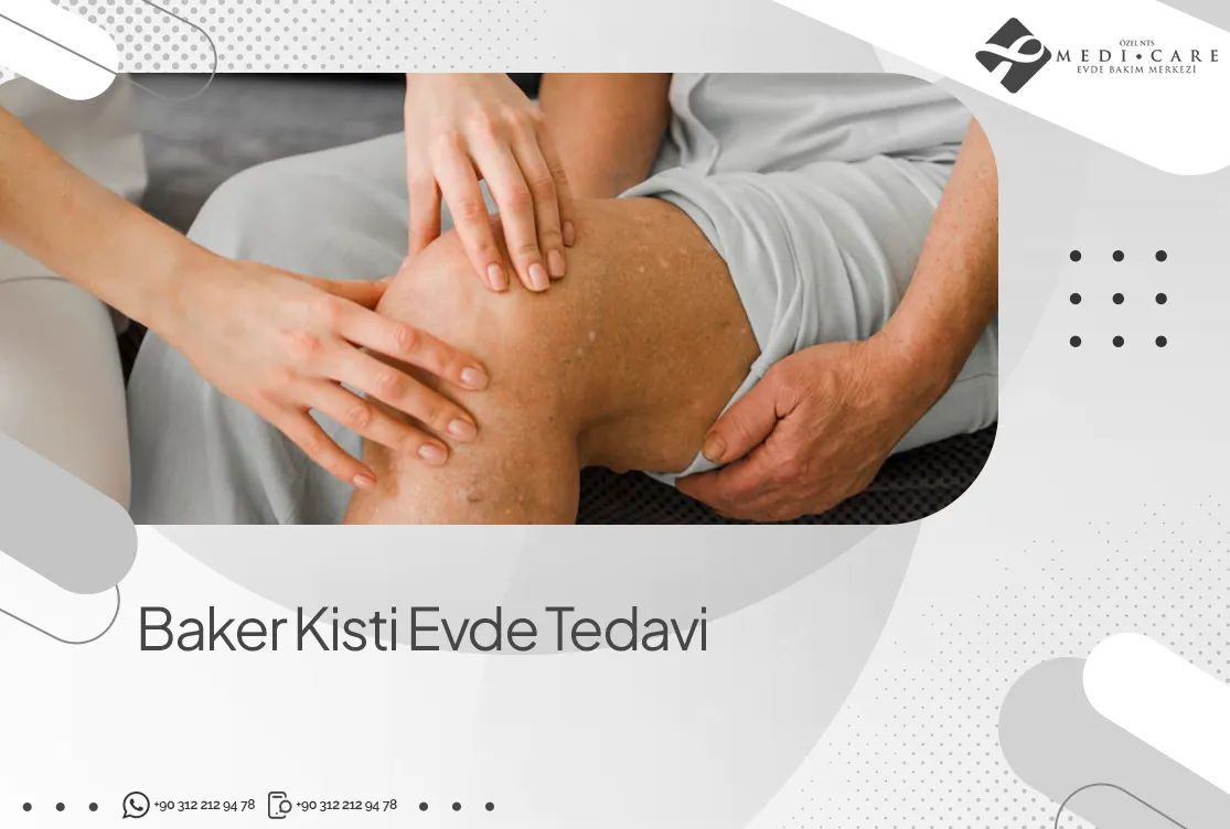 Baker Kisti Evde Tedavi