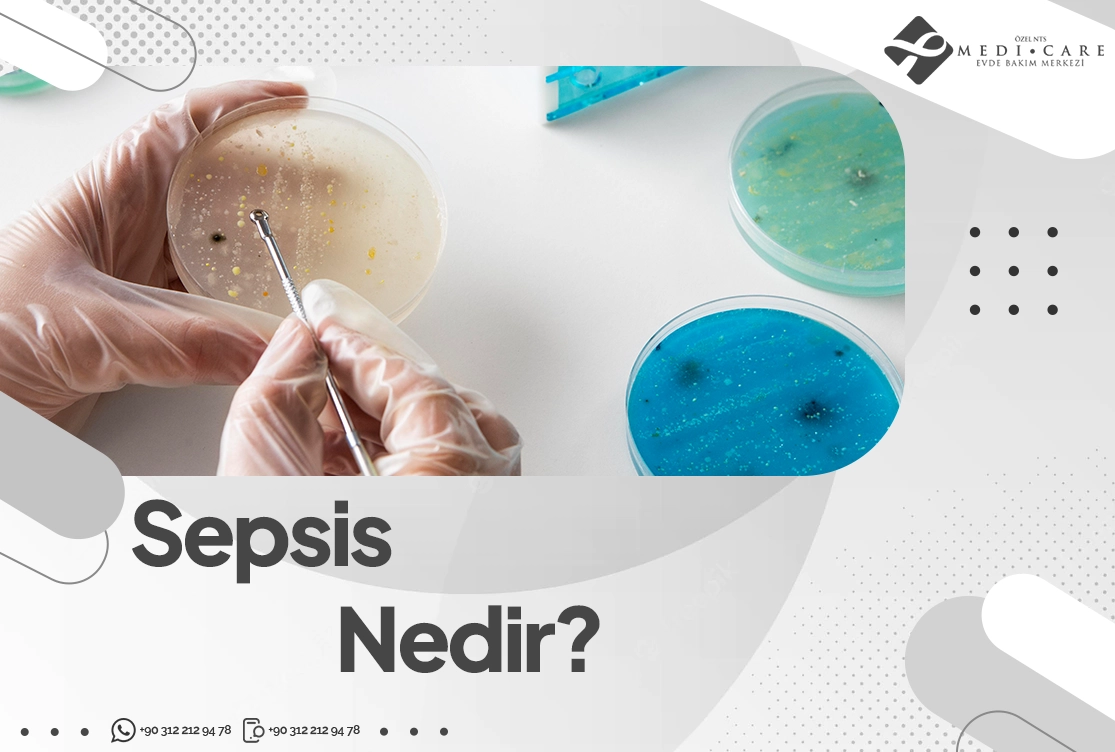 sepsis-nedir