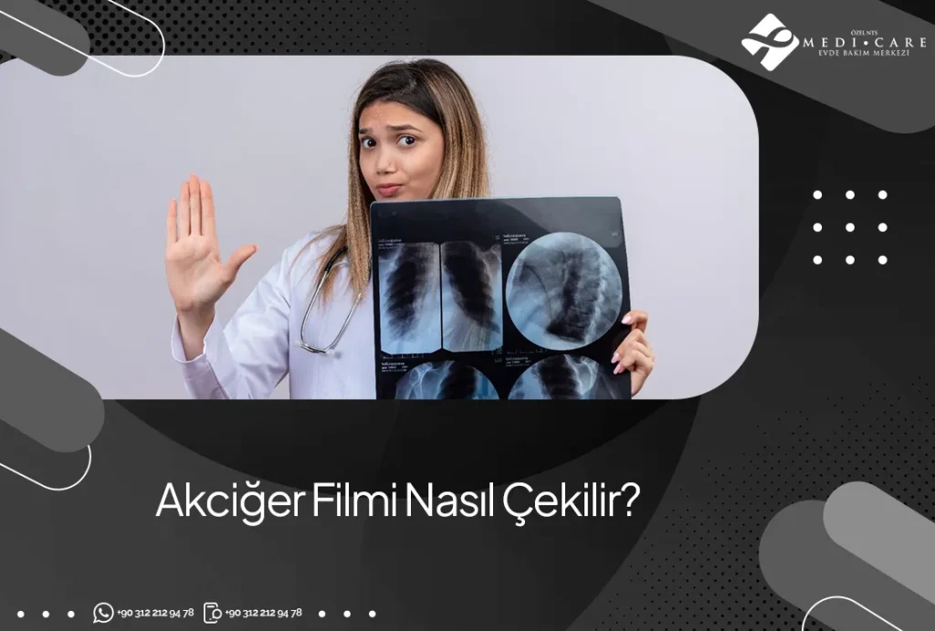 akciger-filmi-nasil-cekilir