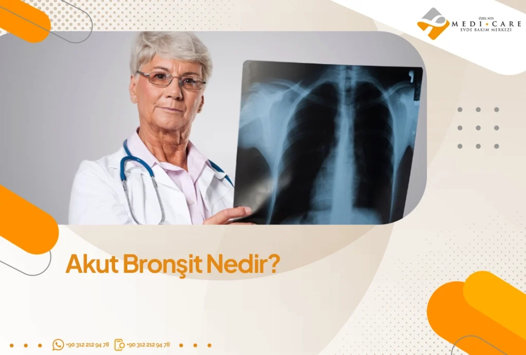 Akut Bronşit Nedir?