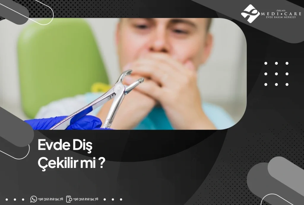 Evde Diş Çekilir Mi?