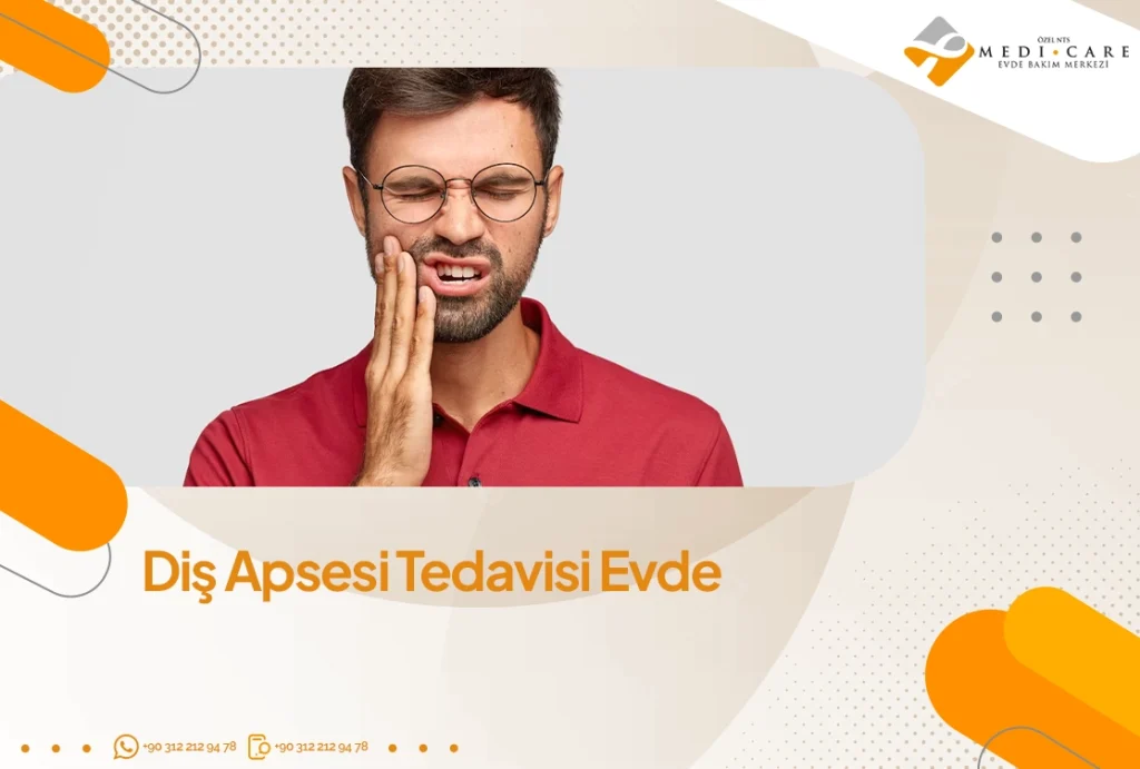 Diş Apsesi Tedavisi Evde