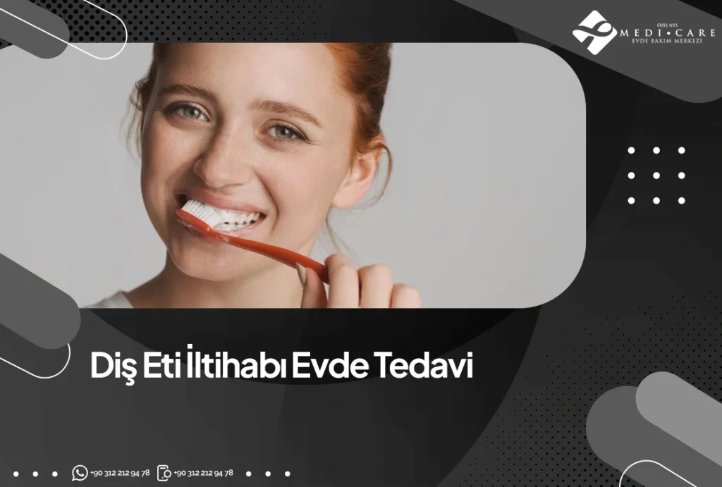 Diş Eti İltihabı Evde Tedavi