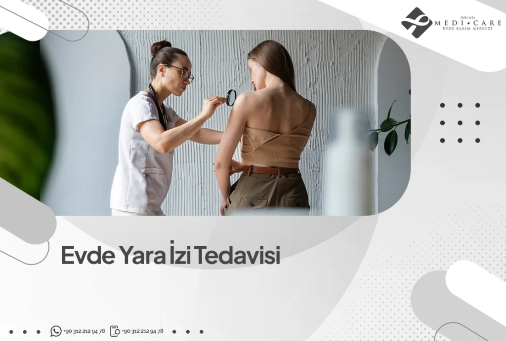 Evde Yara İzi Tedavisi