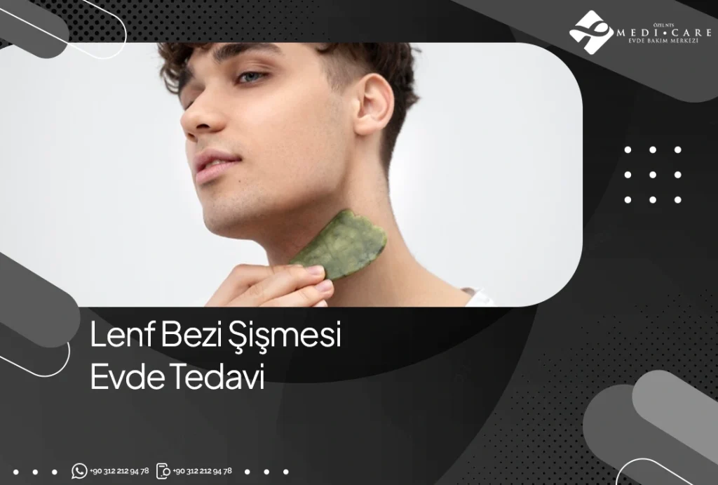 Lenf Bezi Şişmesi Evde Tedavi