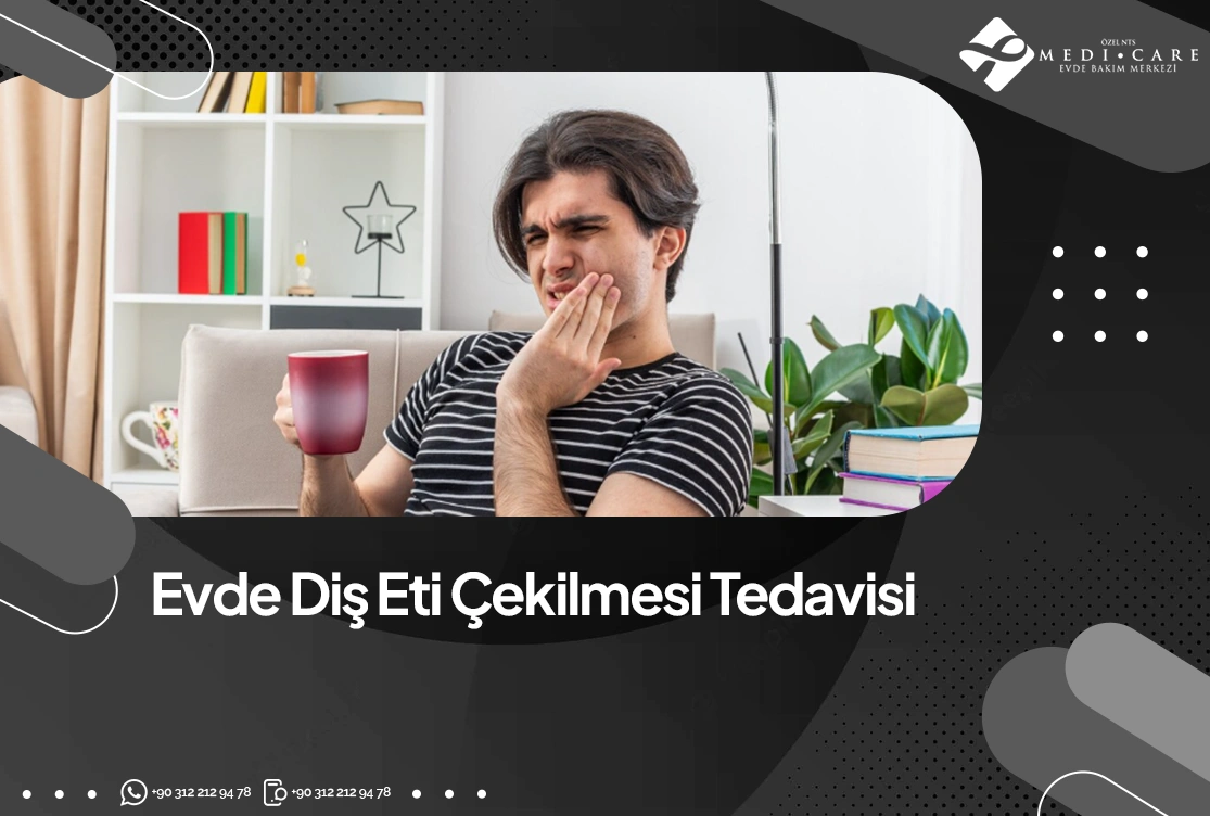 Evde Diş İltihabı Nasıl Tedavi Edilir?