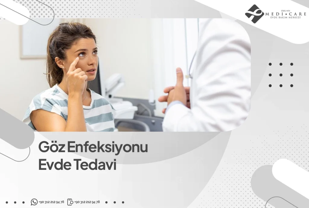 Göz Enfeksiyonu Evde Tedavi