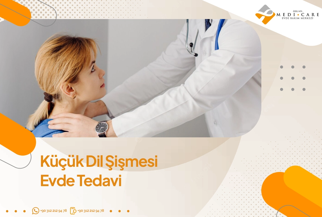 Küçük Dil Şişmesi Evde Tedavi