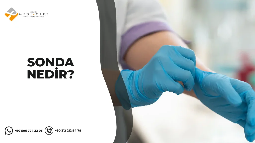 sonda nedir
